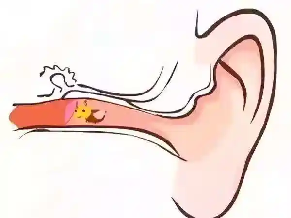 /www/bananadaily.net/web/images/image/2275/22752374.avif