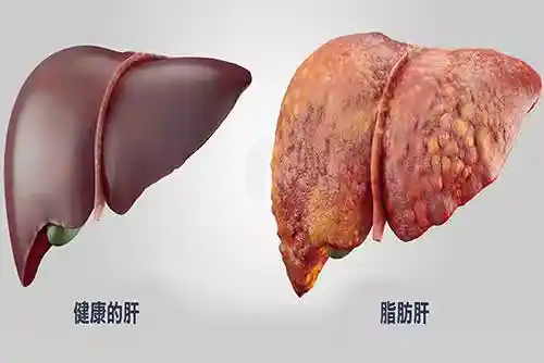 /www/bananadaily.net/web/images/image/2275/22752426.avif